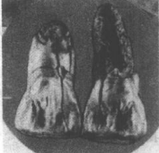 早期中国原始人类有哪些|中国猿人是哪四种？