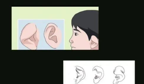 关于耳相的看法！