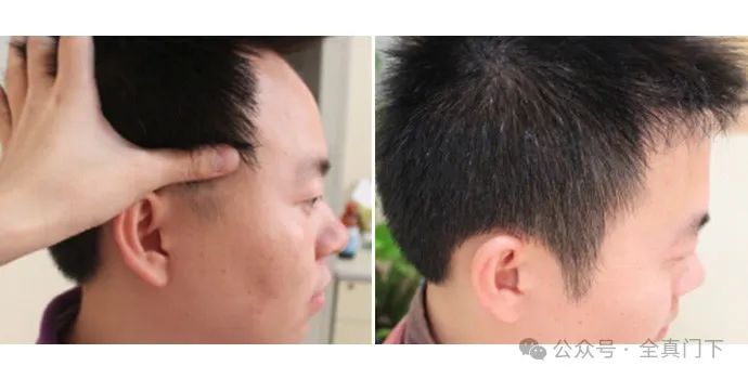 鬓发的秘密：古代相书论鬓发