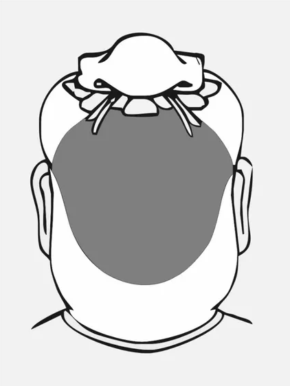 “头生九龙骨，早晚必显贵！”九龙骨是种什么面相？