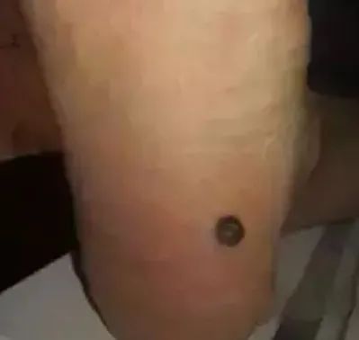 中医学——脚上的健康密码