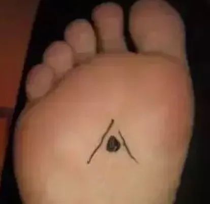 中医学——脚上的健康密码