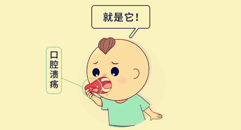 文章标题-3 口腔溃疡反复发作,中医如何解读?有何治疗方法?