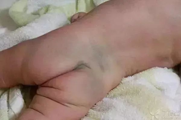 你身上是否有胎记？不同位置蕴含不同寓意！