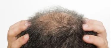 存不到钱的手面相特征！