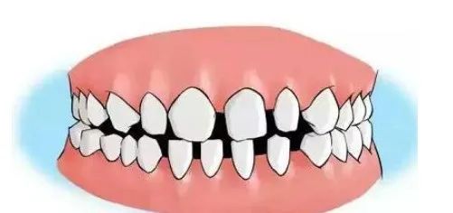 存不到钱的手面相特征！