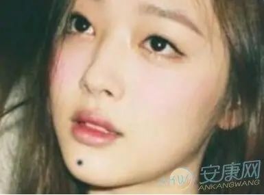 文章标题-3 面部常见痣相的吉凶意义!