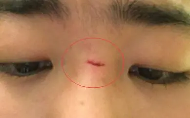 相学——面相铁口直断四十招（上、下）全篇