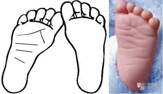 相学——脚相：看脚知运势