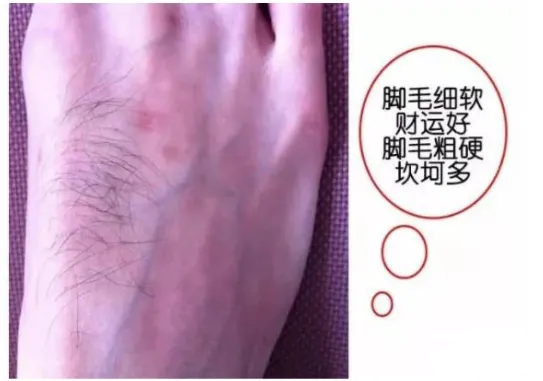 相学——脚相：看脚知运势