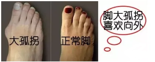 相学——脚相：看脚知运势