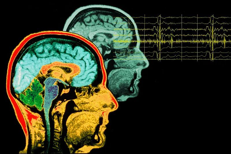 文章标题-3 人的“意念”到底有多强大?竟然可以改善健康与疾病!
