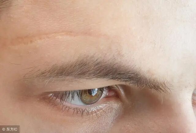 文章标题-2 如何算出身上藏有疤痕