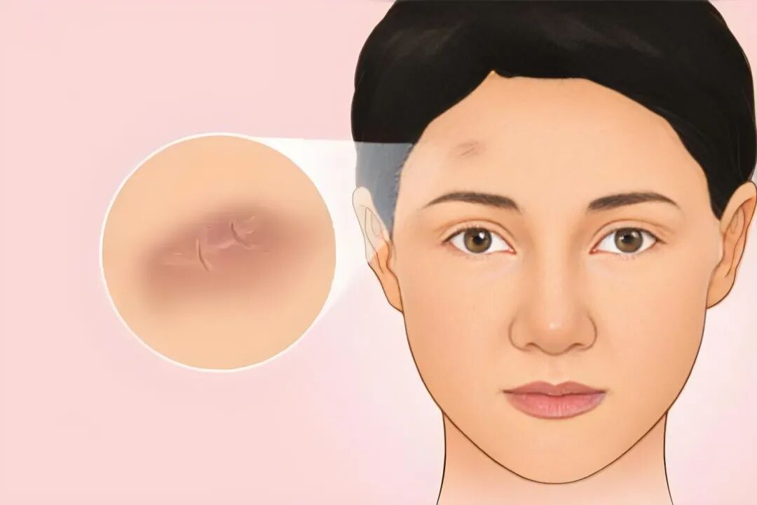 文章标题-2 破相影响运势,都代表着哪些寓意?