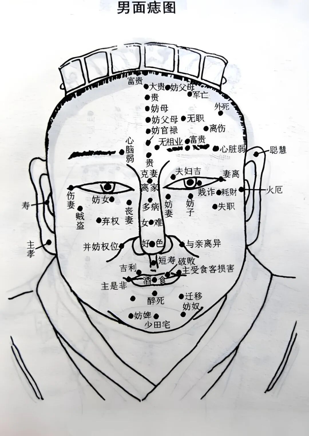 文章标题-2 身痣多吉,面痣多忌:男人痣相全身32处吉凶