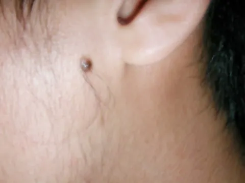 文章标题-5 警告!这几处的毛,拔一根损三分福气