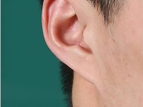 文章标题-6 警告!这几处的毛,拔一根损三分福气