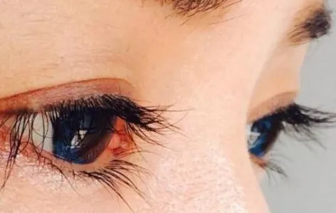 文章标题-4 警告!这几处的毛,拔一根损三分福气